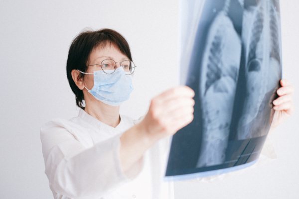 Ärztin vergleicht 2 Röntgen-Aufnahmen der Lunge